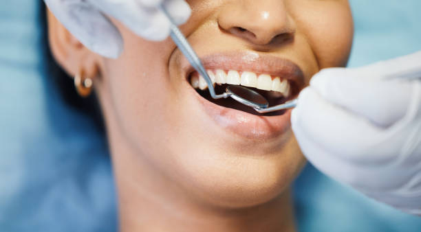 Best Walk-In Emergency Dental Services in Huntington Beach, CA